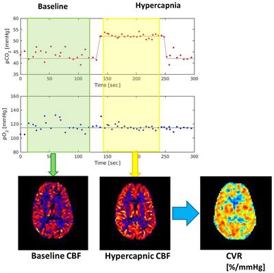 Relationship Between Cerebrovascular Reactivity and Cognition Among People With Risk of Cognitive Decline